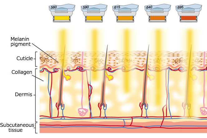 Varying wavelengths and depths of penetration for photofacial