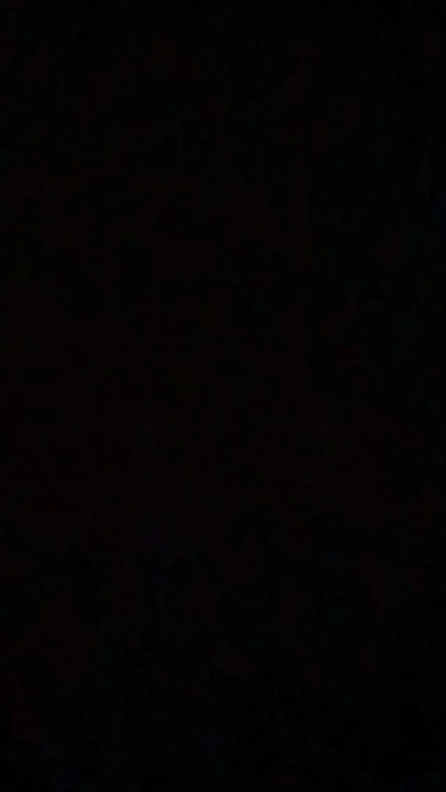 💉✨ It’s National Botox Day, and we’re falling in love again (and again) with smooth, effortless confidence.

At Heights Laser Centre, Botox is more than a treatment, it’s a craft we’ve perfected over the years. With 20+ years of injection experience, it continues to be Dr. Jaffer’s go-to for achieving natural, refreshed, confidence-boosting results. It’s a product we truly love, trust, and stand behind every single day.